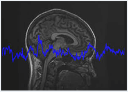 Dr. Paul Swingle - Dr. Swingle's Treatment of Emotional Trauma